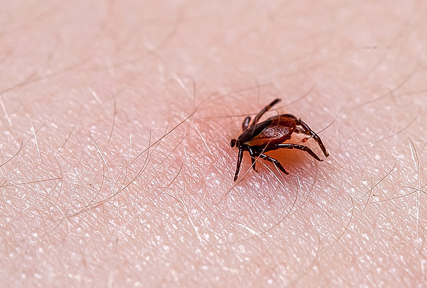 Washington is an Epicenter for Lyme Disease. Here’s How to Protect Yourself.